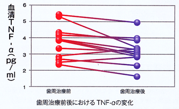 歯周治療前後におけるTNF-αの変化